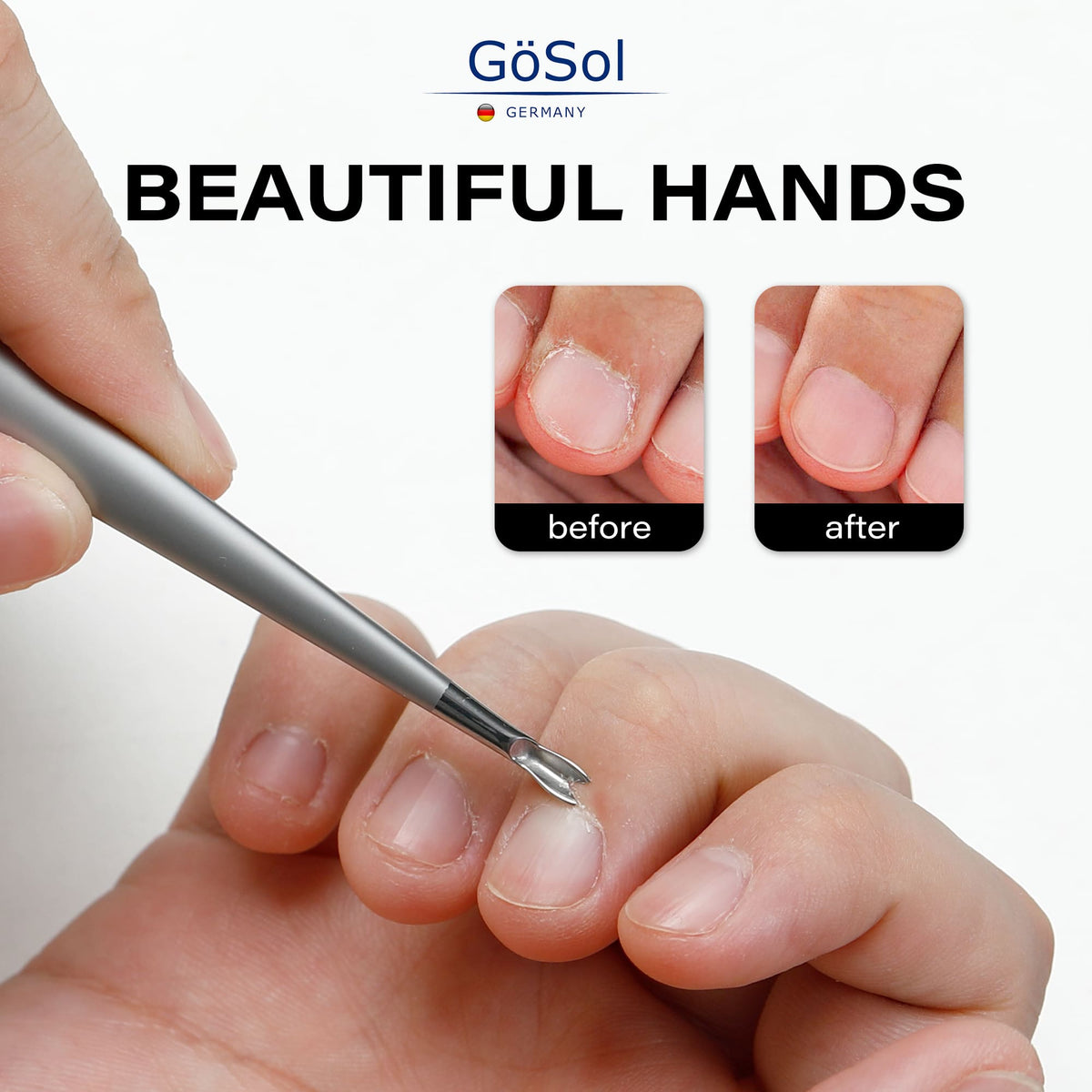 GöSol Stainless Steel Dead Skin Fork Cuticle Trimmer Manicure Pedicure Nail Art Tool