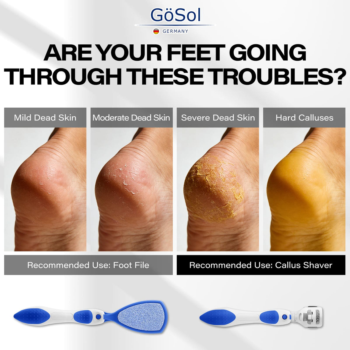 GöSol Foot Callus Remover Set – Foot File with 10 Replacements, Removes Hard & Dead Skin